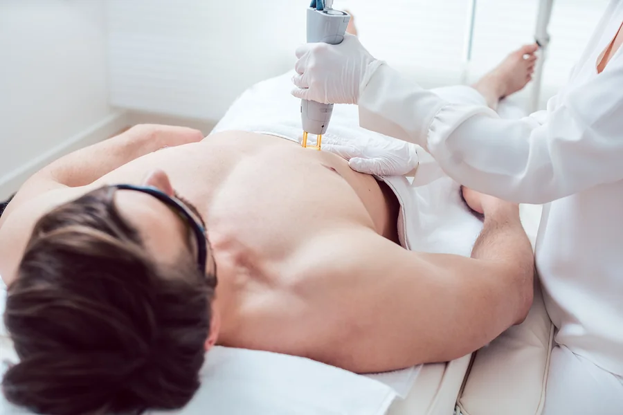 Laser Hair Removal